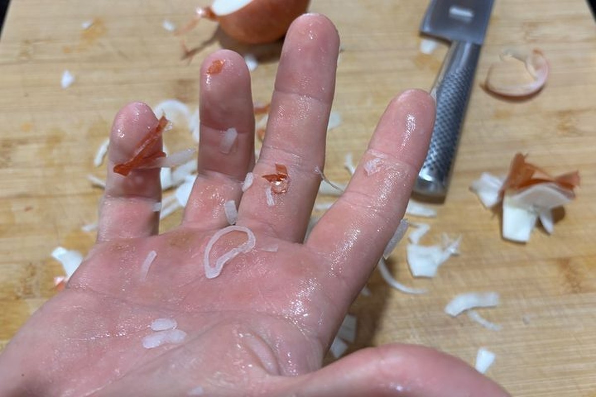 Plíseň na stěně zmizí za 24 hodin, když použijete obyčejný ocet a cibuli - image 1