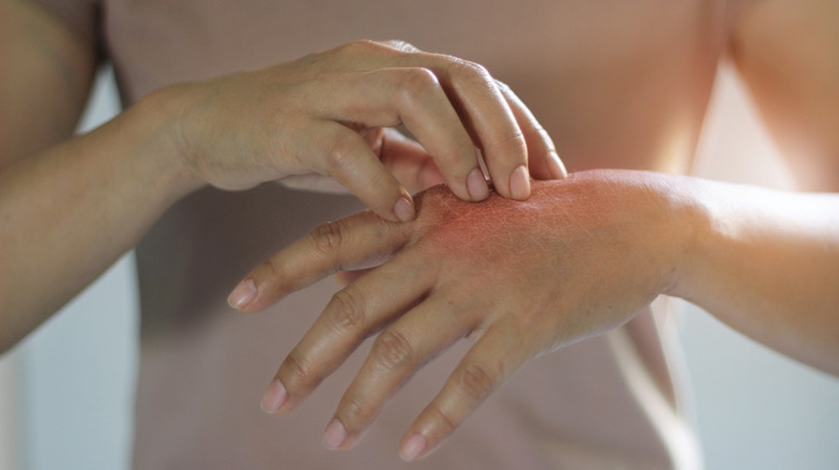 Škrábání umělým nehtem na spáleniště? Lékárníci překvapeni - image 2