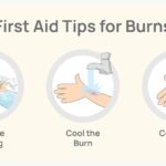 Sůl a ocet na spáleniště: domácí lék za groš místo masti